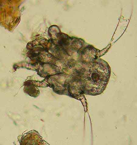 photograph of an ear mite